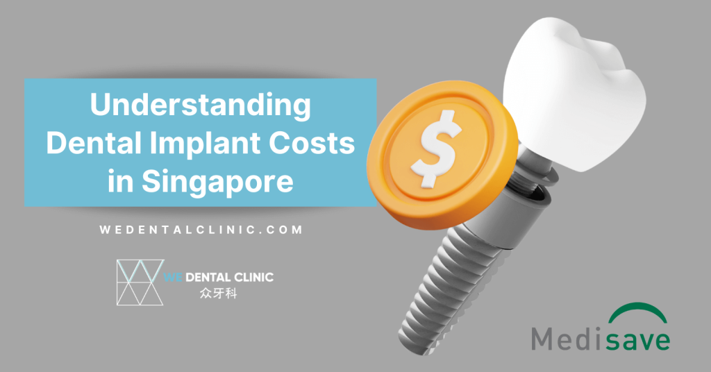 dental implant cost singapore