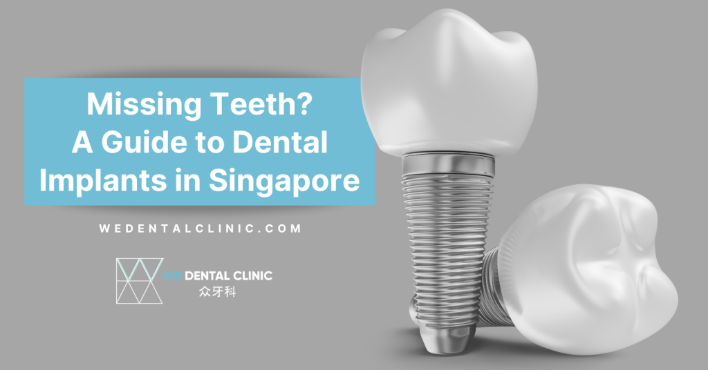 missing teeth? a guide to dental implants in singapore banner
