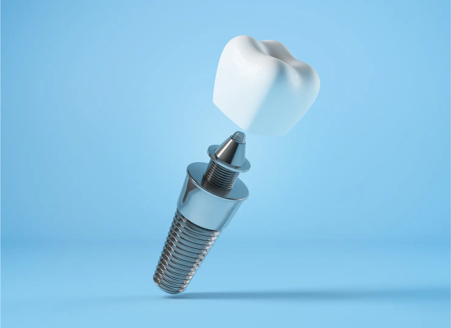dental implant with crown